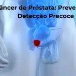 Cancer de Prostata Prevencao e Deteccao Precoce