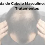 Queda de cabelo masculino causas e tratamentos